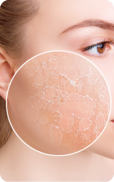 bibiotic derma helps